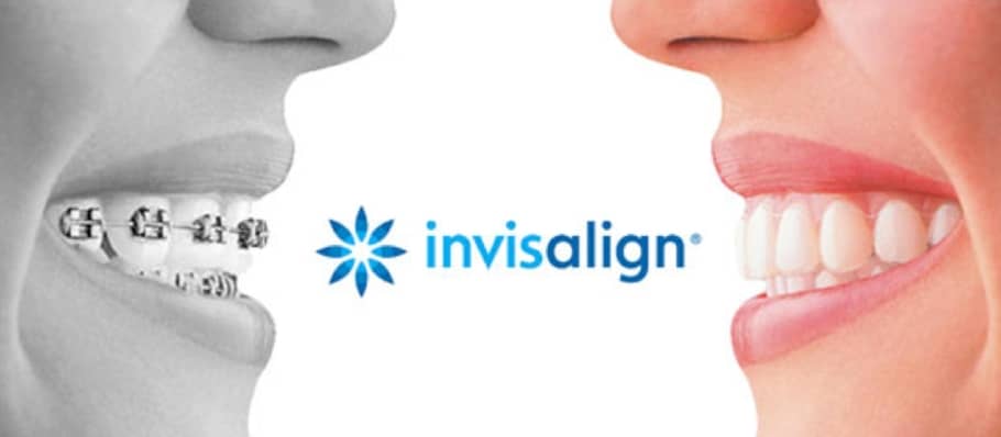 Invisalign